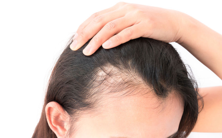 hair loss treatments at hugh campbell in Limerick hair loss treatments at hugh campbell in Limerick